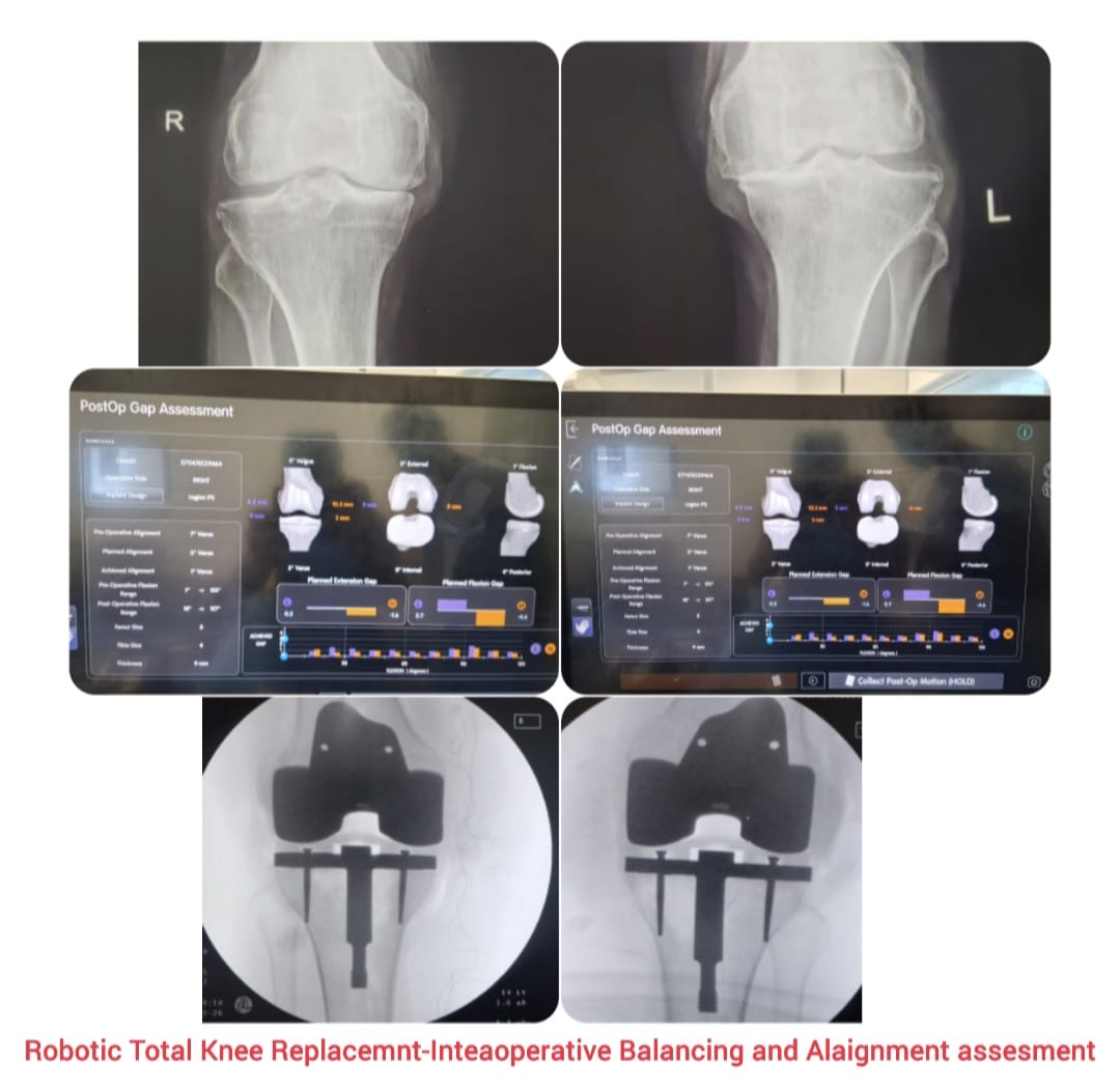 Knee X-ray 5